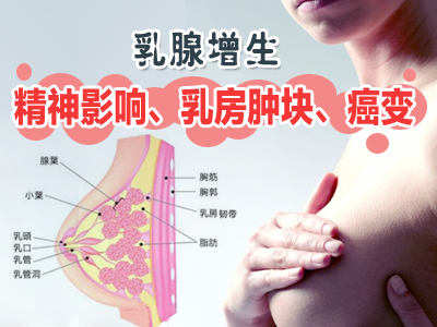 乳腺增生有哪些症状表现